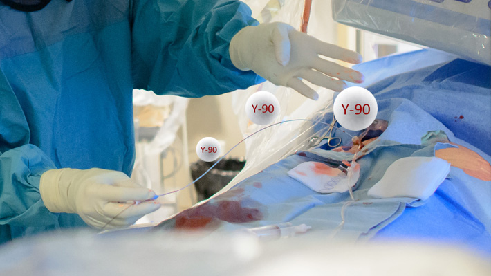 Разработка РФП для терапии рака печени и воспалительных заболеваний суставов разной этиологии на основе микросфер альбумина меченных Y-90 и Tc-99m