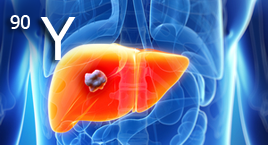 Разработка РФП для терапии рака печени и воспалительных заболеваний суставов разной этиологии на основе микросфер альбумина меченных Y-90 и Tc-99m